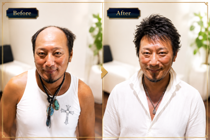 男性用ウィッグ