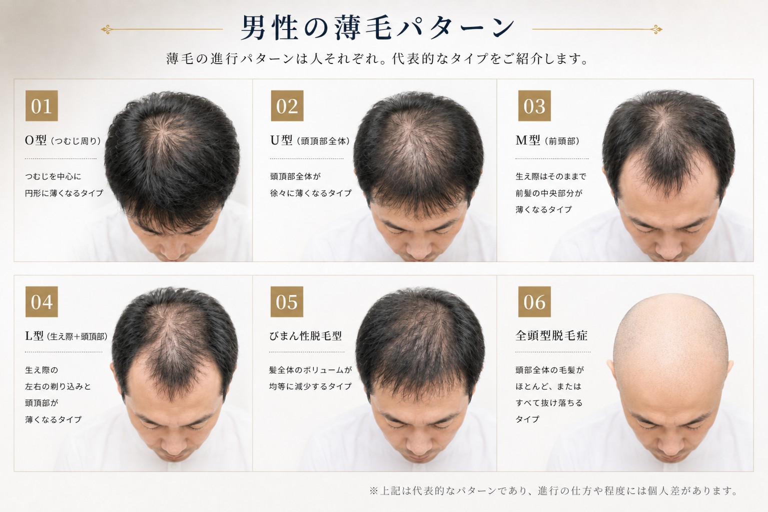 男性用ウィッグ