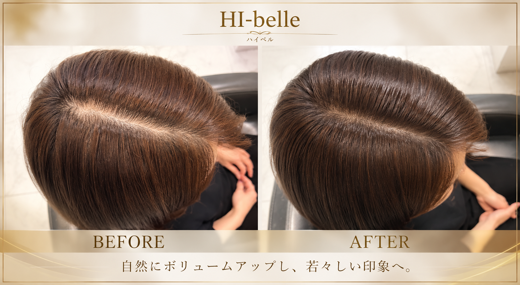 最新ヘアピース　YURARE