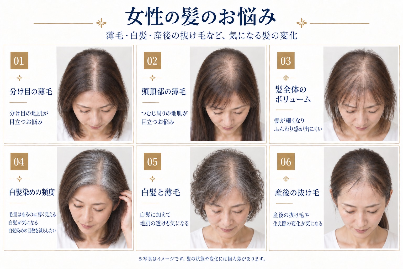 女性用ウィッグ